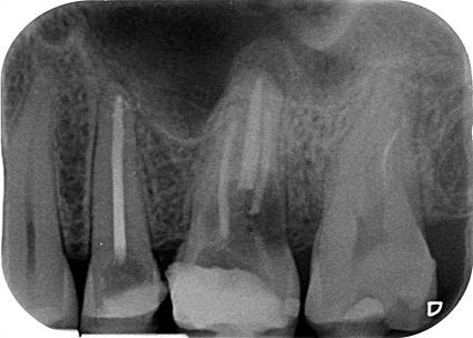 Permite ver las zonas de interés con mayor definición y detalle, permite establecer una relación con estructuras adyacentes anatómicas o patológicas.